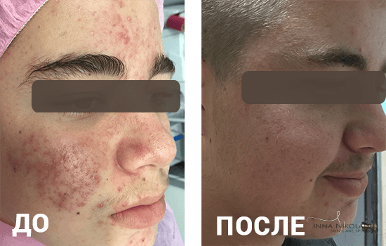 ВОТ ТАКИЕ РЕЗУЛЬТАТЫ У МОИХ КЛИЕНТОК